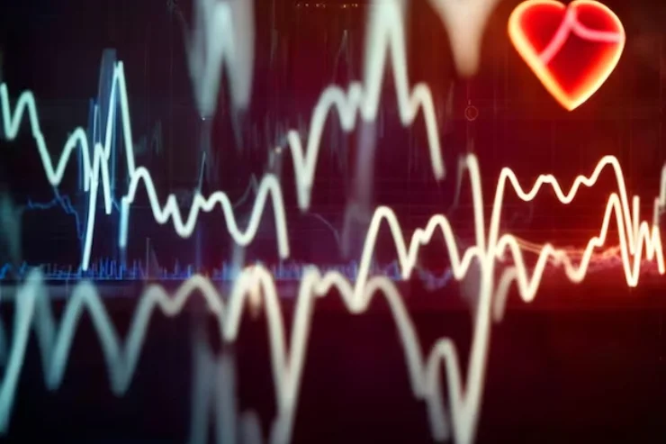 Computerized 12-lead ECG & Rhythm Strip ECG