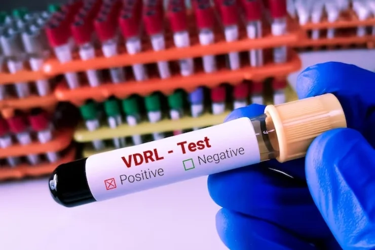 HIV, Syphilis, Gonorrhoea tests