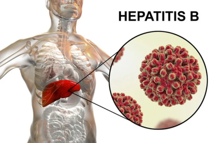 Hepatitis B Staging Pack