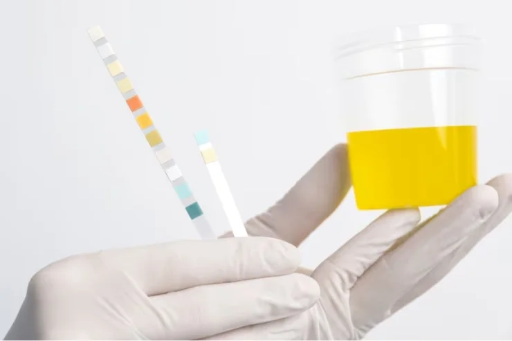 Urine & Stool Tests