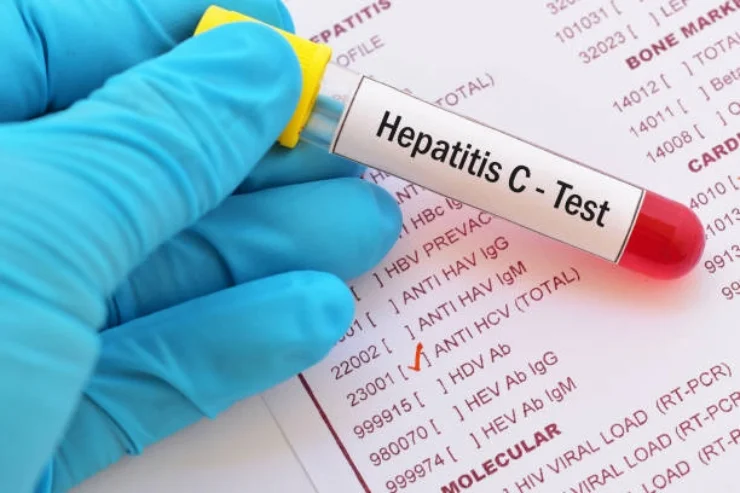 Viral Hepatitis screening pack